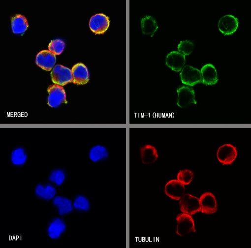 TIM-1 Recombinant Rabbit mAb (S-1555-147)
