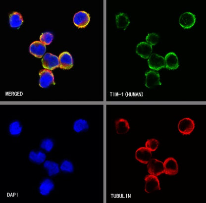 TIM-1 Recombinant Rabbit mAb (S-1555-147)