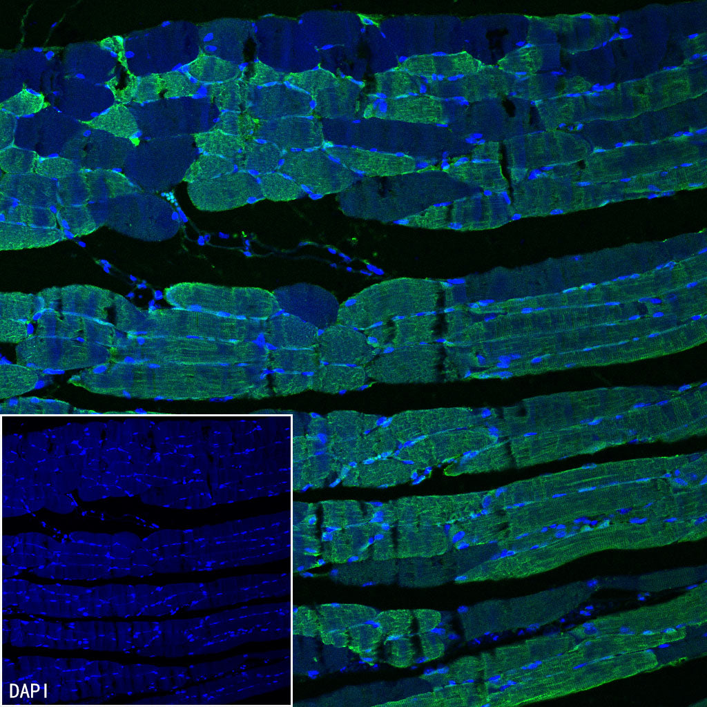 Myoglobin Recombinant Rabbit mAb (S-6197)