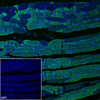 Myoglobin Recombinant Rabbit mAb (S-6197)