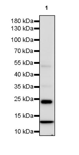 Symmetric Dimethyl Arginine (SDMA) Rabbit mAb (S-2129-14)