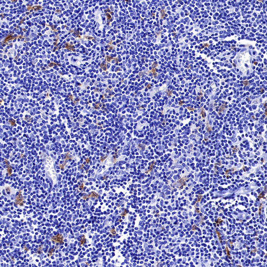 CLEC9A Recombinant Rabbit mAb (S-1904-154)
