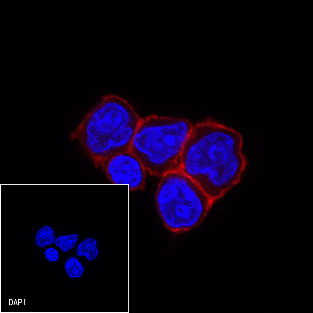 CD38 Recombinant Rabbit mAb (Alexa Fluor® 594 Conjugate) (S-031-45-2)