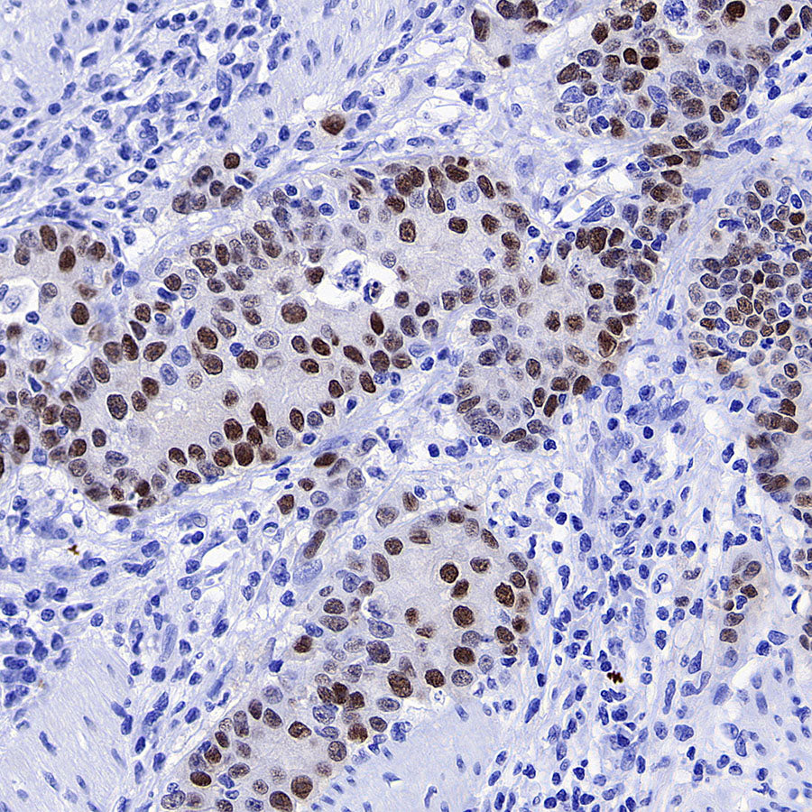 POU2F3 Recombinant Rabbit mAb (S-5525)