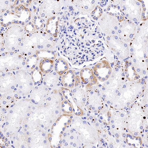 TFAM Recombinant Rabbit mAb (S-1018-53)