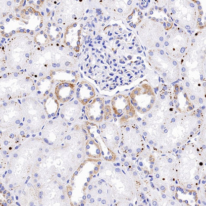 TFAM Recombinant Rabbit mAb (S-1018-53)