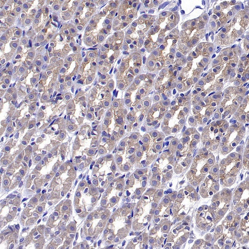 ADRB2 Recombinant Rabbit mAb (S-2418-144)
