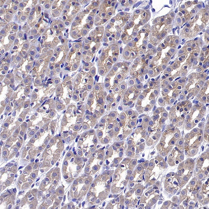 ADRB2 Recombinant Rabbit mAb (S-2418-144)