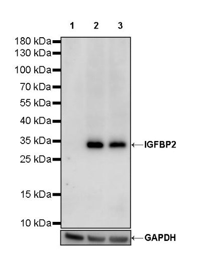IGFBP2 Recombinant Rabbit mAb (S-808-24)