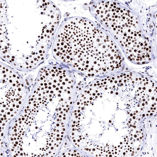 Histone H3 (mono methyl K36) Recombinant Rabbit mAb (S-R396)