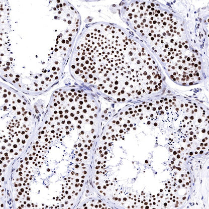 Histone H3 (mono methyl K36) Recombinant Rabbit mAb (S-R396)