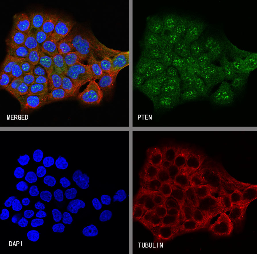 S-RMab® PTEN Recombinant Rabbit mAb (SDT-R069)
