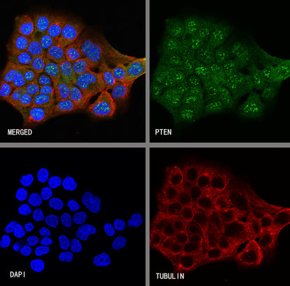 S-RMab® PTEN Recombinant Rabbit mAb (SDT-R069)