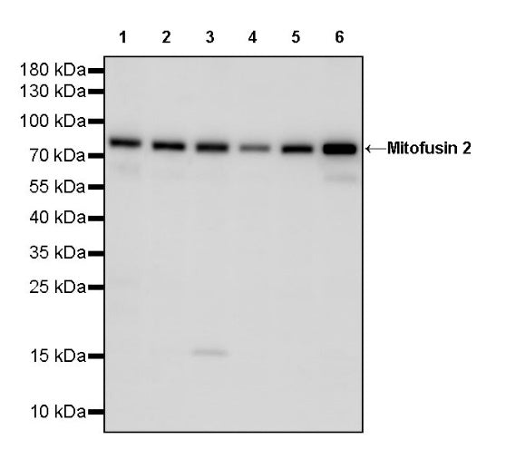 Mitofusin 2 Recombinant Rabbit mAb (S-1783-49)