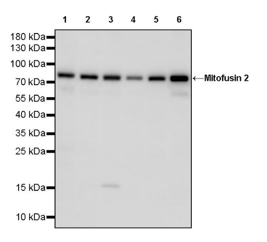 Mitofusin 2 Recombinant Rabbit mAb (S-1783-49)