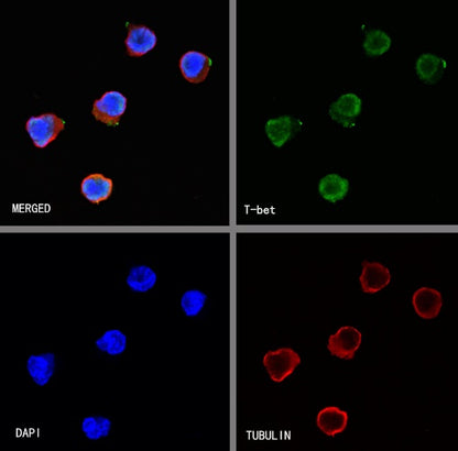 T-bet/TBX21 Recombinant Rabbit mAb (S-583-54)