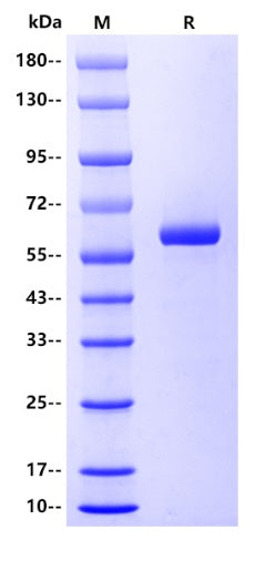 Human LAG-3 Protein, His tag