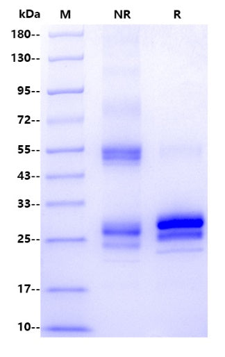 TL1A/TNFSF15 His Tag Protein, Human