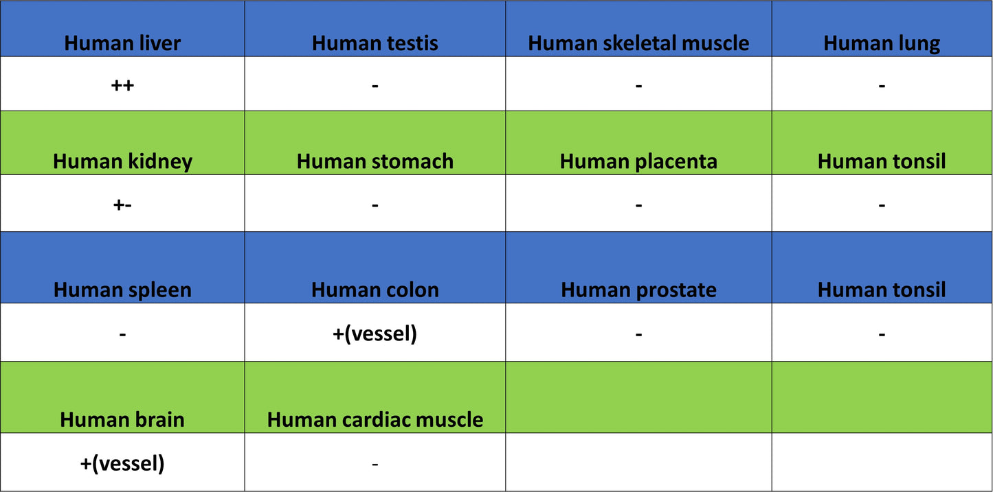 Serum Amyloid A Recombinant Rabbit mAb (S-5308)