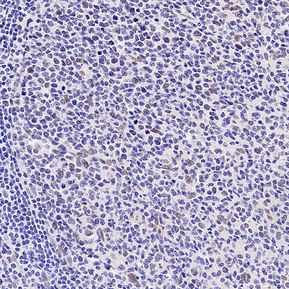 Phospho-ATM (Ser1981) Recombinant Rabbit mAb (S-3396)