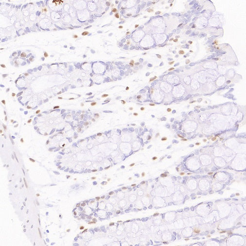 Cleaved Caspase-3 (Asp175) Recombinant Rabbit mAb (S-1406-409)