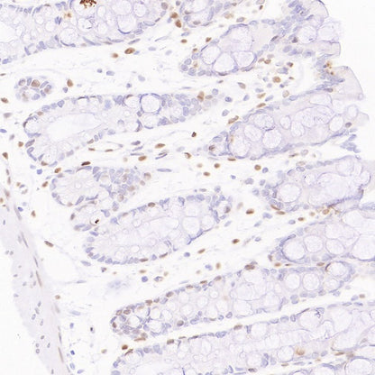 Cleaved Caspase-3 (Asp175) Recombinant Rabbit mAb (S-1406-409)