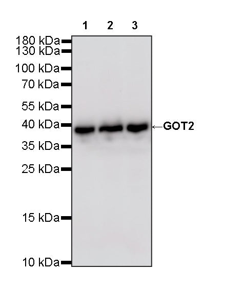 GOT2 Recombinant Rabbit mAb
