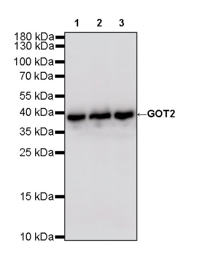 GOT2 Recombinant Rabbit mAb