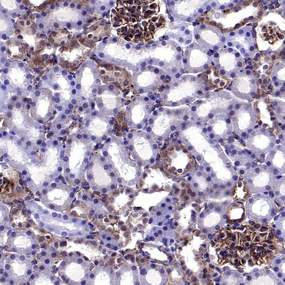 VAMP2 Recombinant Rabbit mAb (S-2359-2)