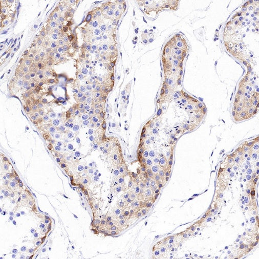 NF-κB2 p100/p52 Recombinant Rabbit mAb (S-2502-208)