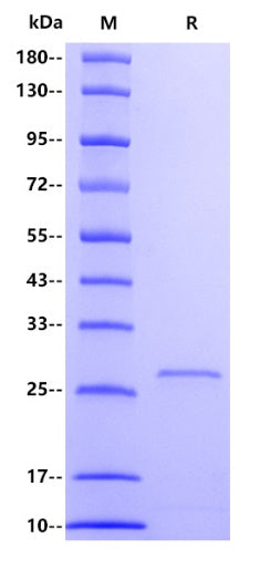 Human SOCS3 Protein, His tag