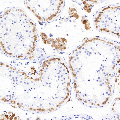 PGP9.5 Recombinant Mouse mAb (S-6071)