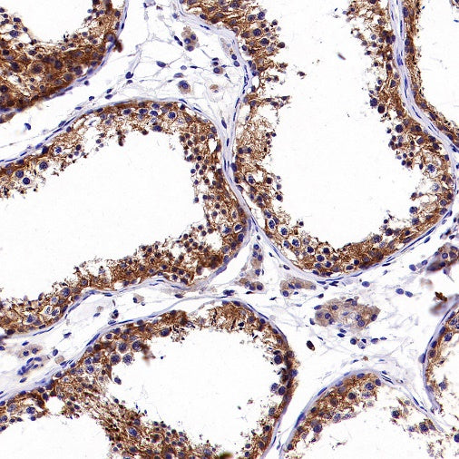 Dynamin 2 Recombinant Rabbit mAb (S-1751-209)