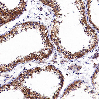 Dynamin 2 Recombinant Rabbit mAb (S-1751-209)