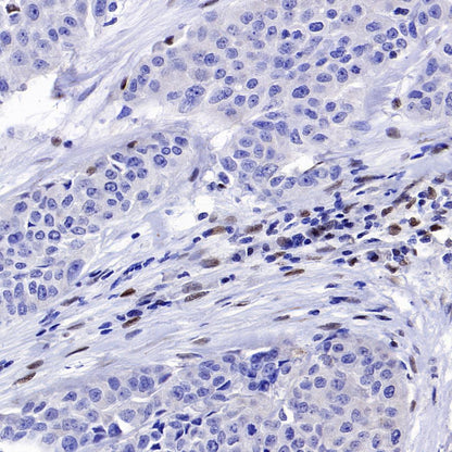 SLFN11 Recombinant Mouse mAb (S-1565-283)