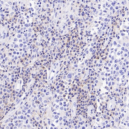 TIGIT Recombinant Rabbit mAb (S-4600)