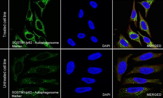 SQSTM1/p62 Recombinant Rabbit mAb (S-R346)