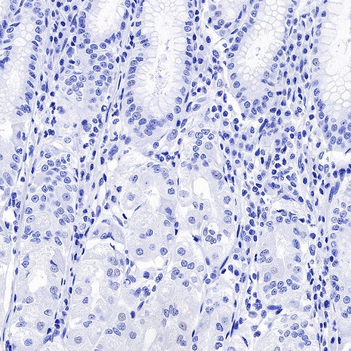 DDX4 Recombinant Rabbit mAb (S-1570-48)