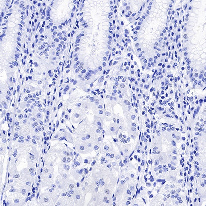 DDX4 Recombinant Rabbit mAb (S-1570-48)