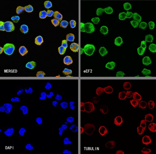eEF2 Recombinant Rabbit mAb (S-1976-35)