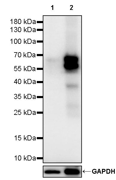 Cytokeratin 1 Recombinant Rabbit mAb (SDT-3225-22)