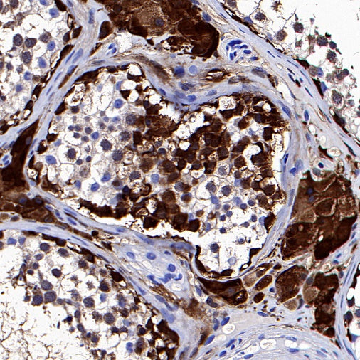 UCHL1 Rabbit Polyclonal Antibody