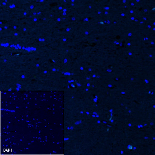 Cardiac Troponin I Recombinant Rabbit mAb (S-1352-15)