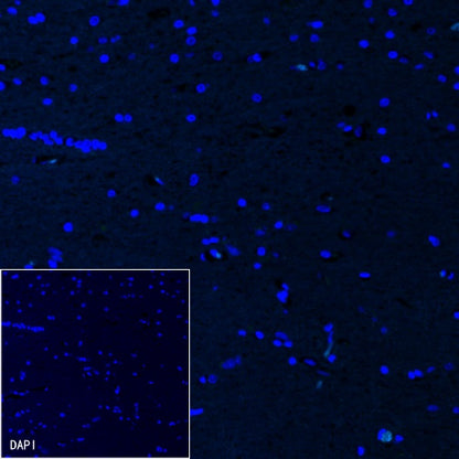 Cardiac Troponin I Recombinant Rabbit mAb (S-1352-15)