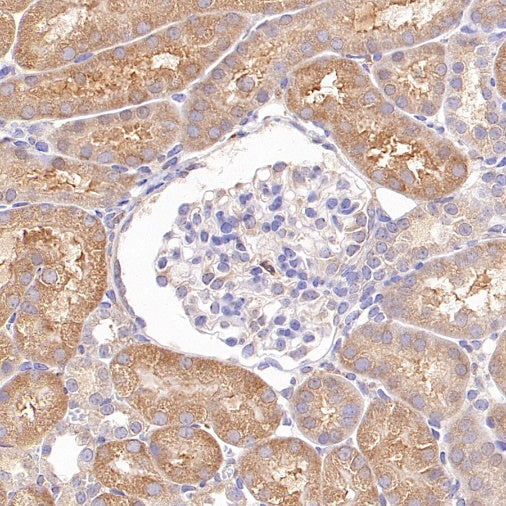 eIF5A Rabbit Polyclonal Antibody