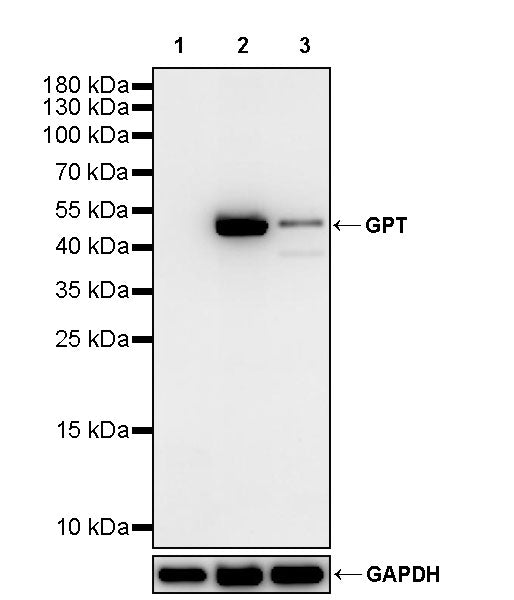 GPT Rabbit Polyclonal Antibody