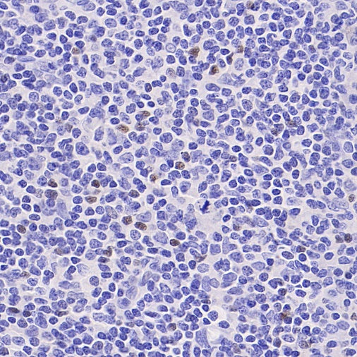 FOXP3 Recombinant Mouse mAb, PBS Only (SDT-3494)
