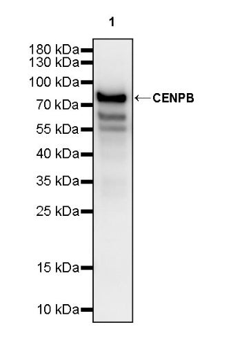 CENPB Recombinant Rabbit mAb (S-1713-209)