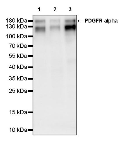 PDGFR alpha Recombinant Rabbit mAb (SDT-3353)