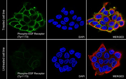 Phospho-EGFR (Tyr1173) Recombinant Rabbit mAb (S-1187-106)